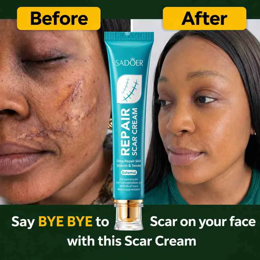 Facial scarring   before / after