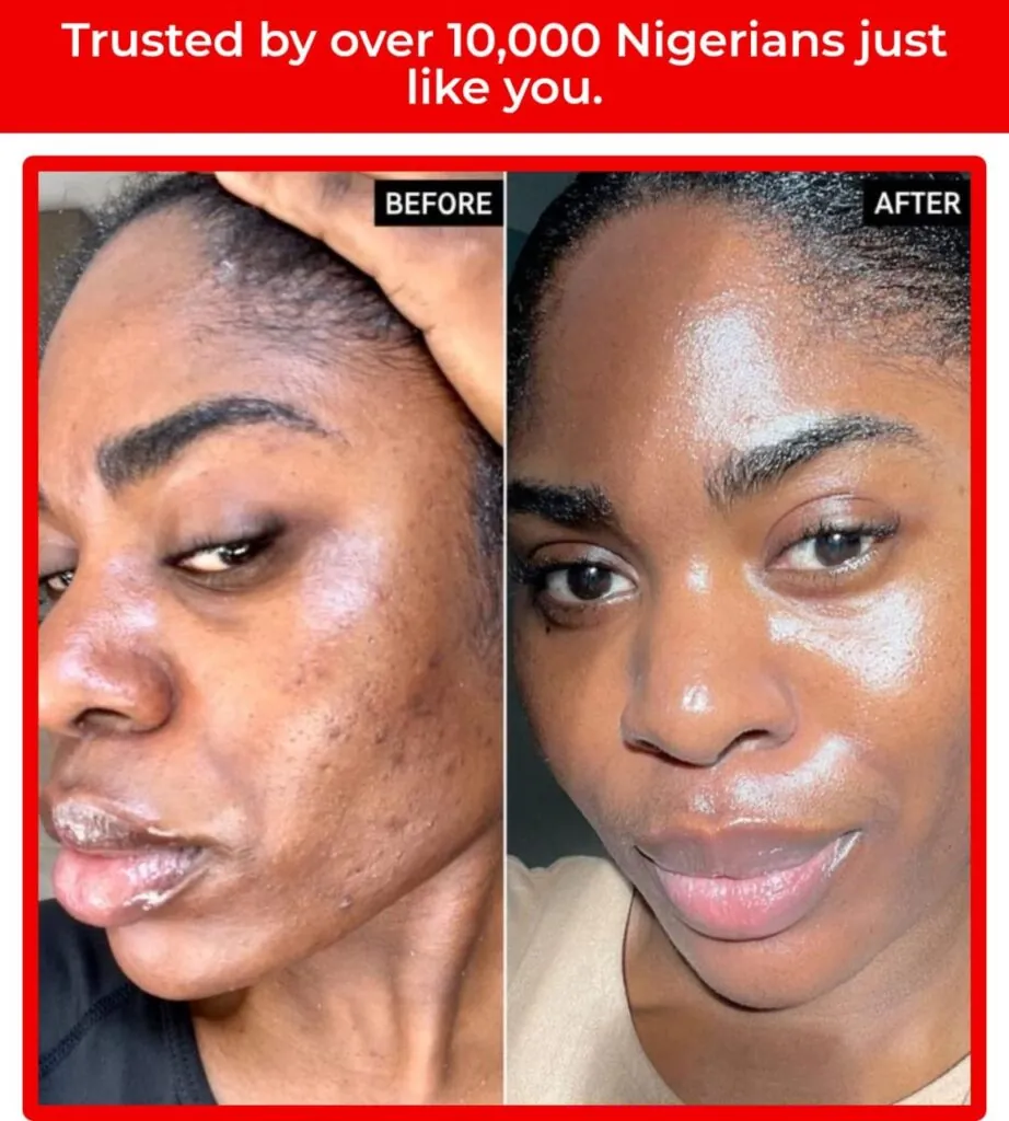 Facial scarring   customer